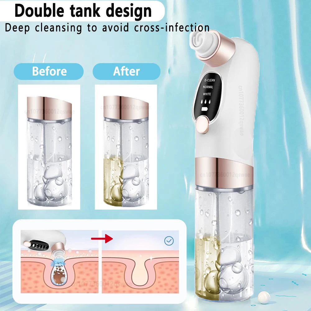 USB Rechargeable Pore Electric Face Cleaner