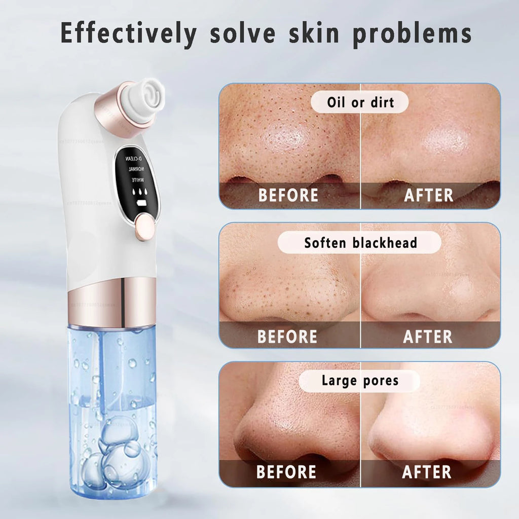 USB Rechargeable Pore Electric Face Cleaner